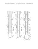 Rotational Atherectomy Device with Fluid Inflatable Support Elements and     Distal Protection Capability diagram and image