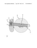 BONE PLATE FOR ELASTIC OSTEOSYNTHESIS diagram and image