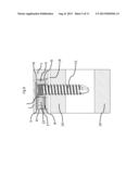 BONE PLATE FOR ELASTIC OSTEOSYNTHESIS diagram and image