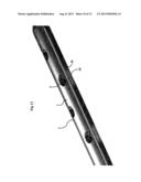 BONE PLATE FOR ELASTIC OSTEOSYNTHESIS diagram and image