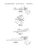 Volar Fixation System diagram and image