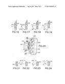 Volar Fixation System diagram and image