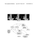 SYSTEM TO DIAGNOSE THE FUNCTION OF INTRINSIC SPHINCTERS diagram and image