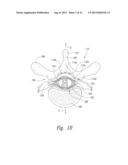 LEAD ANCHORS AND ASSOCIATED SYSTEMS AND METHODS diagram and image