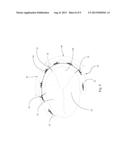 SEMI-FLEXIBLE ANNULOPLASTY RING diagram and image