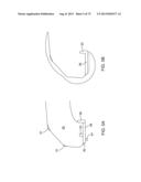 SYSTEMS AND METHODS FOR PROVIDING A MODULAR FEMORAL COMPONENT diagram and image