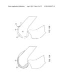 SYSTEMS AND METHODS FOR PROVIDING A MODULAR FEMORAL COMPONENT diagram and image