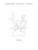 SYSTEMS AND METHODS FOR PROVIDING A MODULAR FEMORAL COMPONENT diagram and image