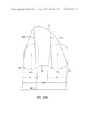 SYSTEMS AND METHODS FOR PROVIDING A MODULAR FEMORAL COMPONENT diagram and image