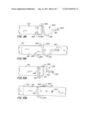 Belt Buckle diagram and image