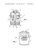 Wearable System for Performing Purifying Therapies of Organic Fluids by     Using Extracorporeal Circuits diagram and image