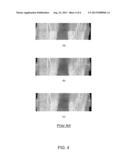 NON-RIGID COMPOSITION OF MULTIPLE OVERLAPPING MEDICAL IMAGING VOLUMES diagram and image