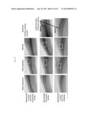 Drug Release from a Polymer-Controlled Local Antibiotic Delivery System     Using a Degradable Bone Graft diagram and image