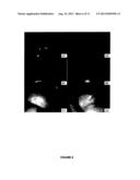 BIODEGRADABLE OCULAR IMPLANT diagram and image