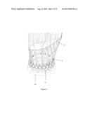 ROD WINDING STRUCTURE IN COMPOSITE DESIGN diagram and image