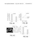 TREATMENT OF HEART FAILURE diagram and image