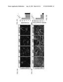 METHOD OF TREATING NEURODEGENERATIVE DISEASES diagram and image