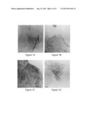 PRODUCTION OF GRAPHENE AND NANOPARTICLE CATALYSTS SUPPORTED ON GRAPHENE     USING MICROWAVE RADIATION diagram and image