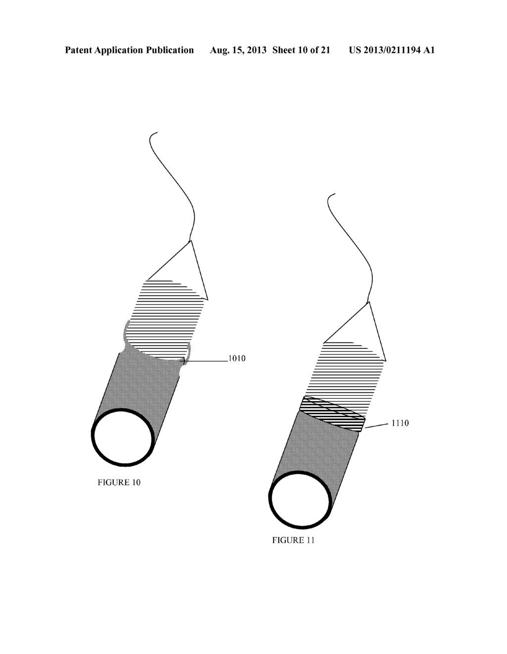 DEVICES, SYSTEMS, AND METHODS FOR IMPROVING ACCESS TO CARDIAC AND VASCULAR     CHAMBERS - diagram, schematic, and image 11