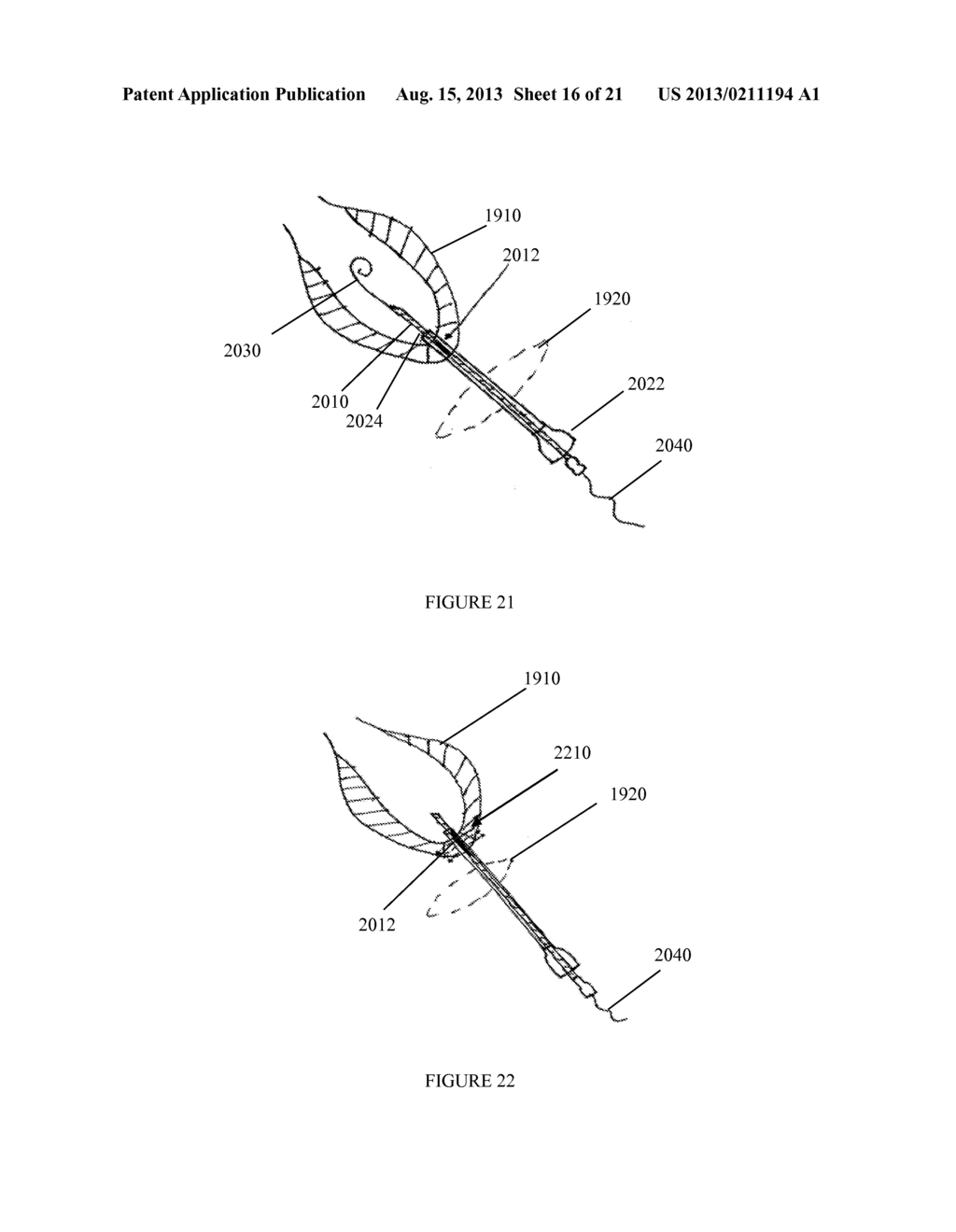 DEVICES, SYSTEMS, AND METHODS FOR IMPROVING ACCESS TO CARDIAC AND VASCULAR     CHAMBERS - diagram, schematic, and image 17