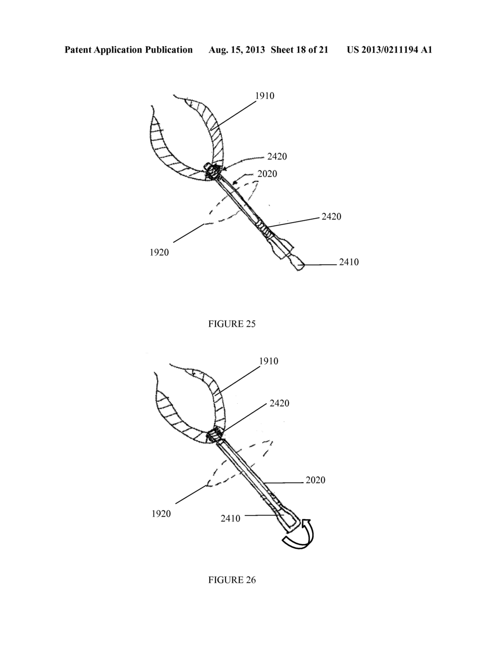 DEVICES, SYSTEMS, AND METHODS FOR IMPROVING ACCESS TO CARDIAC AND VASCULAR     CHAMBERS - diagram, schematic, and image 19