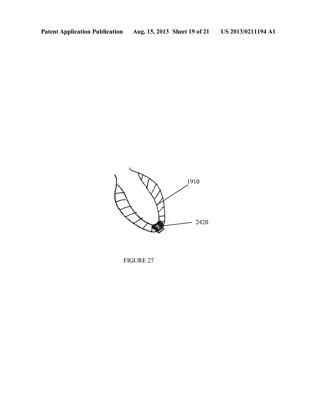 DEVICES, SYSTEMS, AND METHODS FOR IMPROVING ACCESS TO CARDIAC AND VASCULAR     CHAMBERS - diagram, schematic, and image 20