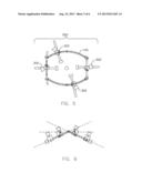 Surgical Retractor diagram and image