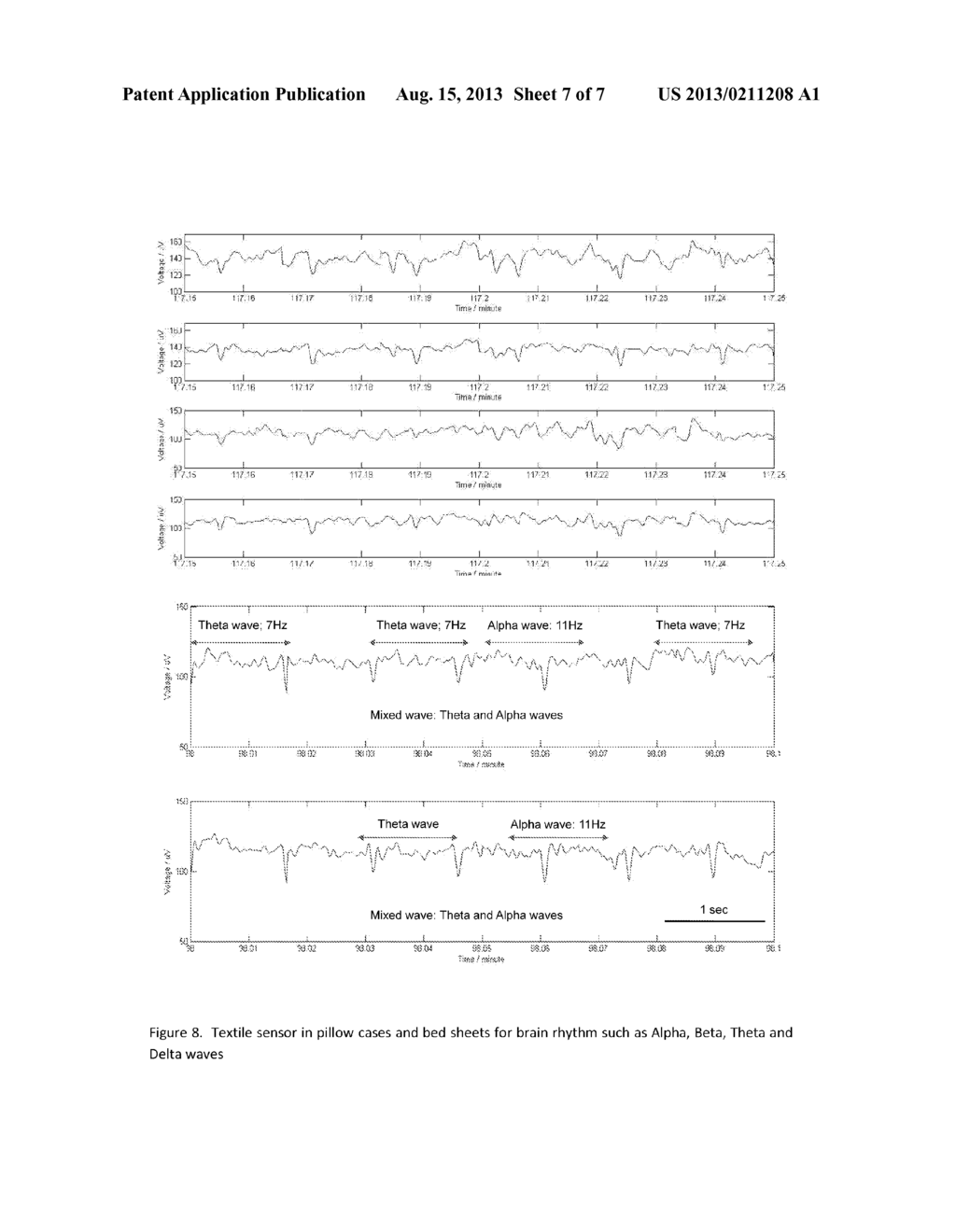 SMART MATERIALS, DRY TEXTILE SENSORS, AND ELECTRONICS INTEGRATION IN     CLOTHING, BED SHEETS, AND PILLOW CASES FOR NEUROLOGICAL, CARDIAC AND/OR     PULMONARY MONITORING - diagram, schematic, and image 08