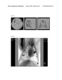 DRUG ELUTING HYDROGELS FOR CATHETER DELIVERY diagram and image