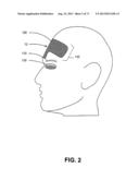 METHODS FOR FACE AND NECK LIFTS diagram and image