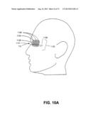 METHODS FOR FACE AND NECK LIFTS diagram and image