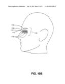 METHODS FOR FACE AND NECK LIFTS diagram and image