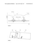 MULTI-MODE INFLATABLE LIMB OCCLUSION DEVICE diagram and image