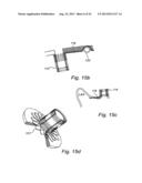 Device, A Kit And A Method For Treatment Of Disorders In The Heart Rhythm     Regulation System diagram and image