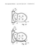 Device, A Kit And A Method For Treatment Of Disorders In The Heart Rhythm     Regulation System diagram and image