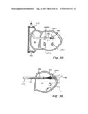 Device, A Kit And A Method For Treatment Of Disorders In The Heart Rhythm     Regulation System diagram and image