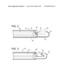 SYSTEM AND METHOD FOR DELIVERING AN ANTI-ADHESIVE SUBSTANCE TO A BODY     CAVITY diagram and image