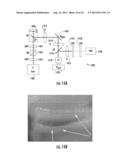 SYSTEMS, DEVICES AND METHODS FOR IMAGING AND SURGERY diagram and image