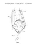 MEDICAL IRRIGATION DEVICE AND METHOD diagram and image