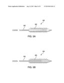 TISSUE REPAIR IMPLANT AND DELIVERY DEVICE AND METHOD diagram and image