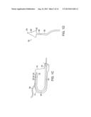 ENDOSCOPIC SUTURE SYSTEMS diagram and image