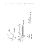 ENDOSCOPIC SUTURE SYSTEMS diagram and image