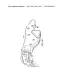 ENDOSCOPIC SUTURE SYSTEMS diagram and image