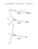 ENDOSCOPIC TOOLS FOR THE REMOVAL OF BALLOON-LIKE INTRAGASTRIC DEVICES diagram and image