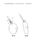 ENDOSCOPIC TOOLS FOR THE REMOVAL OF BALLOON-LIKE INTRAGASTRIC DEVICES diagram and image