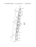 Clavicle Plate and Screws diagram and image