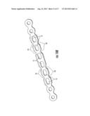 Clavicle Plate and Screws diagram and image