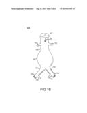 DEVICES AND METHODS FOR APPROXIMATING THE CROSS-SECTIONAL PROFILE OF     VASCULATURE HAVING BRANCHES diagram and image