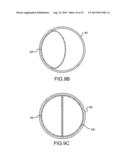 DEVICES AND METHODS FOR APPROXIMATING THE CROSS-SECTIONAL PROFILE OF     VASCULATURE HAVING BRANCHES diagram and image