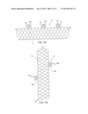 APPARATUS AND METHOD FOR DEPLOYING AN IMPLANTABLE DEVICE WITHIN THE BODY diagram and image